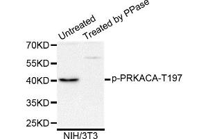 Western blot analysis of extracts of NIH/3T3 cells, using Phospho-PRKACA-T197 antibody. (PRKACA anticorps)