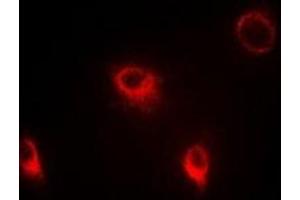 Immunofluorescent analysis of SFRP4 staining in Hela cells.