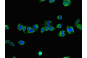 Immunofluorescent analysis of HepG2 cells using ABIN7161568 at dilution of 1:100 and Alexa Fluor 488-congugated AffiniPure Goat Anti-Rabbit IgG(H+L) (NNMT anticorps  (AA 86-157))