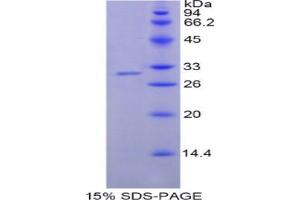 SDS-PAGE analysis of Human NNMT Protein. (NNMT Protéine)