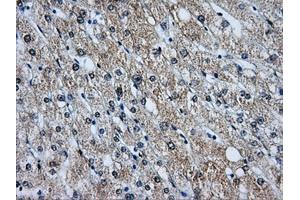 Immunohistochemical staining of paraffin-embedded liver tissue using anti-BIRC7mouse monoclonal antibody. (BIRC7 anticorps)