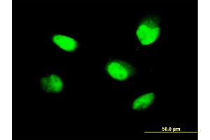 Immunofluorescence of monoclonal antibody to ZNF207 on HeLa cell. (ZNF207 anticorps  (AA 1-110))