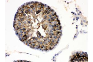Immunohistochemistry (Paraffin-embedded Sections) (IHC (p)) image for anti-Heat Shock Protein 90kDa alpha (Cytosolic), Class A Member 1 (HSP90AA1) (AA 454-488), (C-Term) antibody (ABIN3043848)