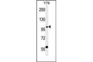 Western blot analysis of PHF20 Antibody (N-term) in Y79 cell line lysates (35ug/lane). (PHF20 anticorps  (N-Term))