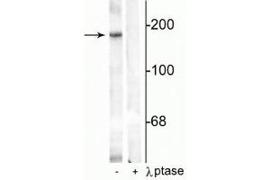 Western blot of rat hippocampal lysate showing specific immunolabeling of the ~180 kDa NR2B subunit phosphorylated at Tyr1336 in the first lane (-). (GRIN2B anticorps  (pTyr1336))