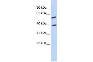 WB Suggested Anti-C6orf146 Antibody Titration: 0. (FAM217A anticorps  (Middle Region))