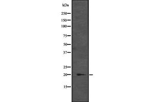 Western blot analysis of CENPM expression in K-562 cell lysate at 25ug/lane,The lane on the left is treated with the antigen-specific peptide. (CENPM anticorps  (Internal Region))