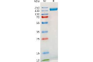 Human Protein, hFc Tag on SDS-PAGE under reducing condition.