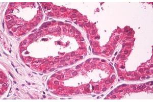 Anti-CXADR antibody IHC staining of human prostate.
