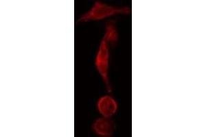 ABIN6275567 staining  Hela cells by IF/ICC. (SH3GLB2 anticorps  (C-Term))