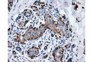 Immunohistochemical staining of paraffin-embedded breast tissue using anti-ANXA1 mouse monoclonal antibody. (Annexin a1 anticorps)