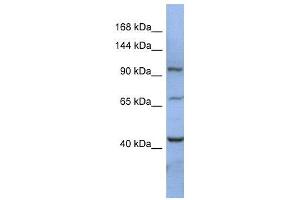 WB Suggested Anti-RBM12  Antibody Titration: 0. (RBM12 anticorps  (N-Term))