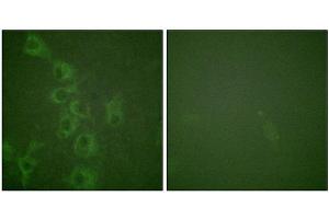 Immunofluorescence staining of methanol-fixed HuvEc cells using Histamine H1 Receptor (Phospho-Ser398) Antibody. (HRH1 anticorps  (pSer398))