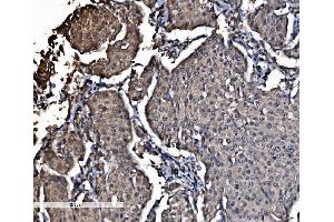 IHC analysis of DYNLL1/PIN using anti-DYNLL1/PIN antibody (ABIN7599571).