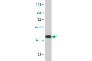 Western Blot detection against Immunogen (36. (ERN1 anticorps  (AA 401-500))