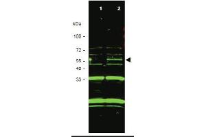 Western blot using anti-ING3 antibody shows detection of a band at. (ING3 anticorps  (Isoform 1))