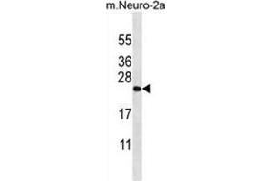 ZCRB1 Antibody (C-term) western blot analysis in mouse Neuro-2a cell line lysates (35 µg/lane). (ZCRB1 anticorps  (C-Term))