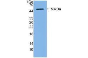Detection of Recombinant CD83, Human using Polyclonal Antibody to Cluster Of Differentiation 83 (CD83) (CD83 anticorps  (AA 24-205))
