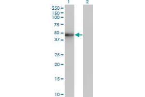 Western Blot analysis of ZNF24 expression in transfected 293T cell line by ZNF24 monoclonal antibody (M02), clone 2G5. (ZNF24 anticorps  (AA 1-368))