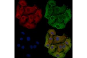 ABIN6257342 and ABIN6275523 staining Hela cells by IF/ICC. (Septin 6 anticorps  (Internal Region))