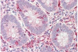 Human Small Intestine: Formalin-Fixed, Paraffin-Embedded (FFPE)