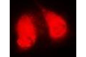 Immunofluorescent analysis of GGA2 staining in MCF7 cells. (GGA2 anticorps)