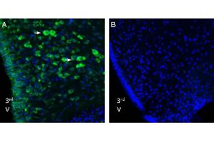 Expression of Nucleobindin-2/Nesfatin-1 in rat hypothalmus. (NUCB2 anticorps  (Intracellular))