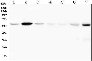 Western blot analysis of FSCN2 using anti-FSCN2 antibody (ABIN7599023).