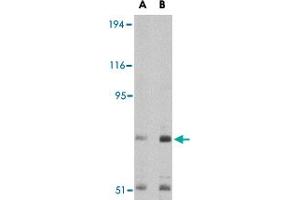 Western blot analysis of TNPO3 in Raji cell lysate with TNPO3 polyclonal antibody  at (A) 1 and (B) 2 ug/mL . (Transportin 3 anticorps  (N-Term))