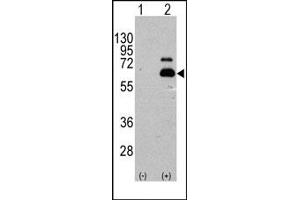 Image no. 1 for anti-Ribosomal Protein S6 Kinase, 70kDa, Polypeptide 1 (RPS6KB1) (Ser404) antibody (ABIN358257) (RPS6KB1 anticorps  (Ser404))