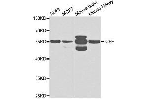 Western Blotting (WB) image for anti-Carboxypeptidase E (CPE) antibody (ABIN1876646) (CPE anticorps)