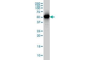 TAPBPL monoclonal antibody (M02), clone 6E3 Western Blot analysis of TAPBPL expression in A-431 . (TAPBPL anticorps  (AA 23-121))