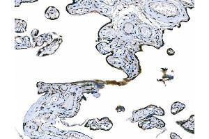 IHC analysis of CD101 using anti-CD101 antibody (ABIN7601981). (CD101 anticorps  (AA 53-904))