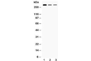 Western blot testing of 1) rat testis, 2) mouse Hepa1-6 and 3) human HepG2 lysate with TECTA antibody at 0. (TECTA anticorps  (AA 93-134))