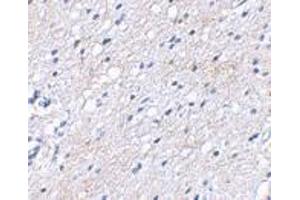 Immunohistochemical staining of human brain tissue using AP30122PU-N BAP3 antibody at 2.