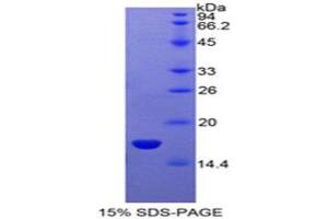 SDS-PAGE (SDS) image for Sema Domain, Immunoglobulin Domain (Ig), Short Basic Domain, Secreted, (Semaphorin) 3A (SEMA3A) (AA 31-141) protein (His tag) (ABIN1880056)