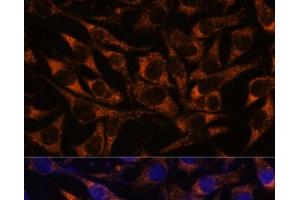 Immunofluorescence analysis of L929 cells using ACAA2 Polyclonal Antibody at dilution of 1:100.