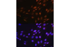 Immunofluorescence analysis of NIH-3T3 cells using SP1 antibody (ABIN7270505).