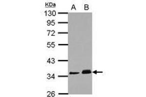 Image no. 1 for anti-Protein Phosphatase 1J (PPM1J) (AA 133-442) antibody (ABIN1500379) (PPM1J anticorps  (AA 133-442))