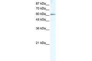 WB Suggested Anti-METTL3 Antibody Titration:  5. (METTL3 anticorps  (Middle Region))