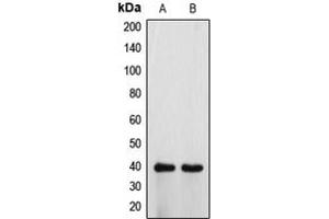 Western blot analysis of ATP6V0D1 expression in HeLa (A), H9C2 (B) whole cell lysates. (ATP6V0D1 anticorps  (Center))