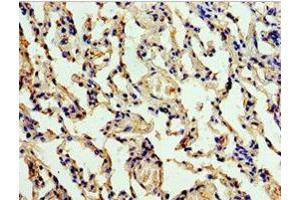 Immunohistochemistry of paraffin-embedded human lung tissue using ABIN7147563 at dilution of 1:100 (ALG1 anticorps  (AA 215-464))