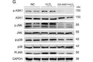 The expression of PLIN5 was regulated by the JNK-p38-ATF pathway. (MAPK14 anticorps  (pThr180, pTyr182))