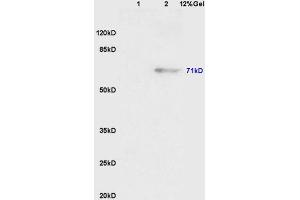 Lane 1: mouse embryo lysates Lane 2: mouse pancreas lysates probed with Anti Phospho-Wee1(Ser123) Polyclonal Antibody, Unconjugated (ABIN756592) at 1:200 in 4 °C. (WEE1 anticorps  (pSer123))