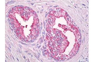 Anti-USP21 antibody IHC of human prostate. (USP21 anticorps  (AA 466-566))