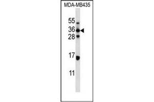 Western blot analysis of ELOVL5 Antibody (C-term) in MDA-MB435 cell line lysates (35ug/lane). (ELOVL5 anticorps  (C-Term))