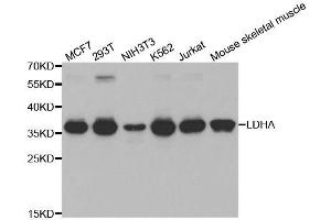 Western blot analysis of extracts of various cell lines, using LDHA antibody. (Lactate Dehydrogenase A anticorps  (AA 1-332))