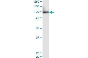 Immunoprecipitation of PRDM1 transfected lysate using anti-PRDM1 MaxPab rabbit polyclonal antibody and Protein A Magnetic Bead , and immunoblotted with .