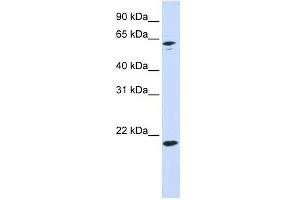 APRT antibody used at 1 ug/ml to detect target protein. (APRT anticorps  (N-Term))