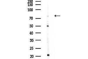 anti-Zinc Finger Protein 709 (ZNF709) (N-Term) antibody